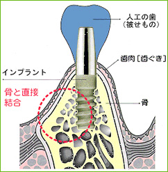 Dummy Images