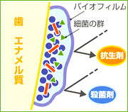 歯科医院で行う予防　PMTC